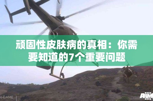 顽固性皮肤病的真相：你需要知道的7个重要问题