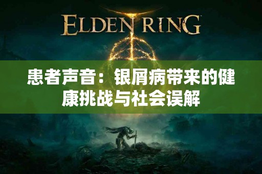 患者声音：银屑病带来的健康挑战与社会误解
