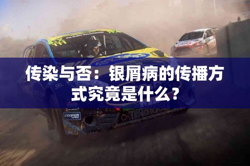 传染与否：银屑病的传播方式究竟是什么？